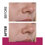 Anti-Spot Cream