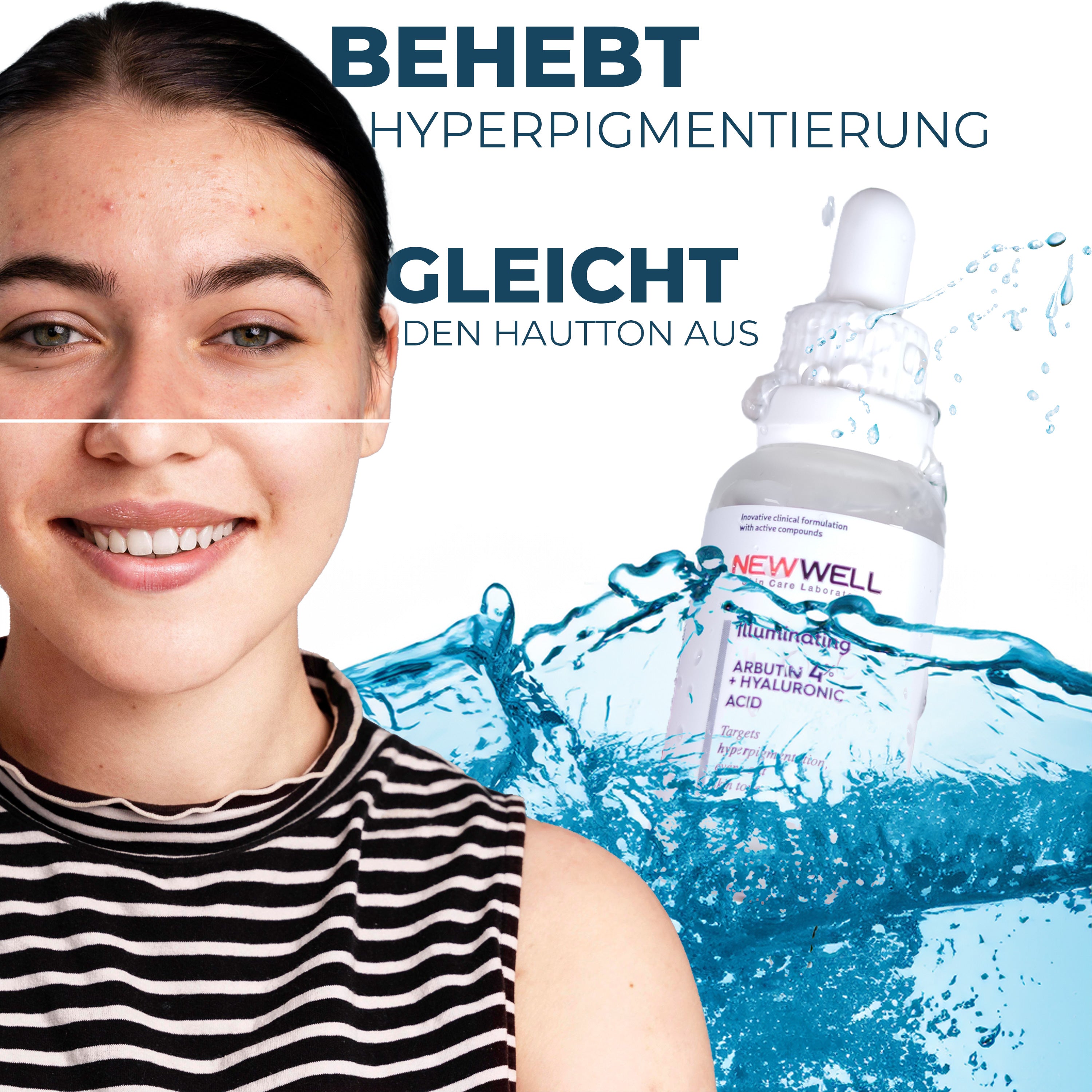 Antibakterielles, Aufhellendes, Arbutin-Hautpflegeserum - Illuminating